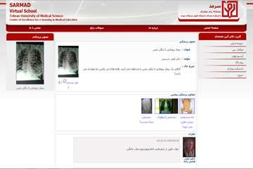 SARMAD02
